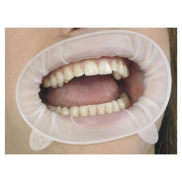 Optragate 3D small refill Ivoclar